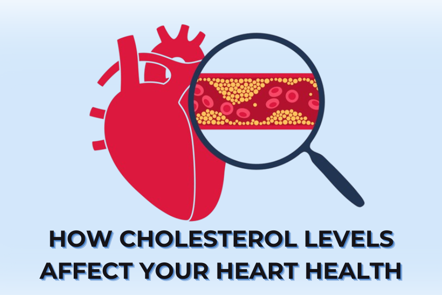 How Cholesterol Levels Affect Your Heart Health