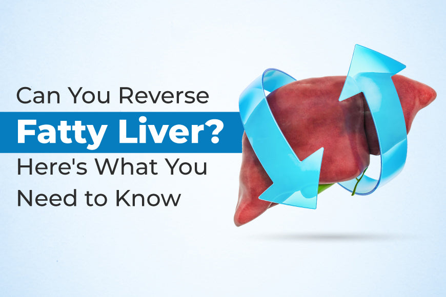 Can You Reverse Fatty Liver? Here's What You Need to Know